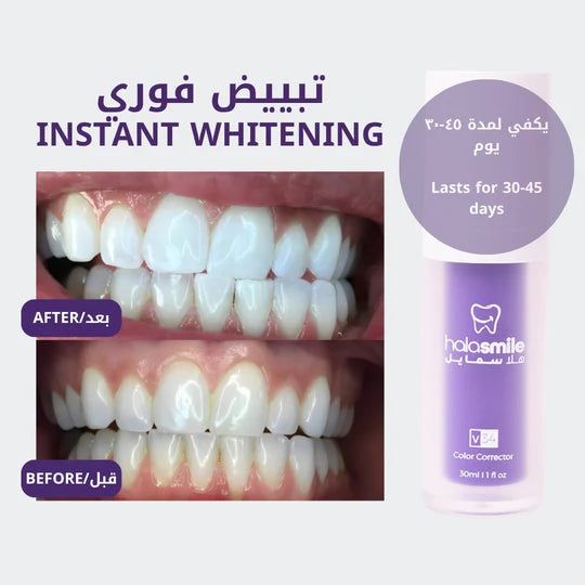 مبيض الأسنان hismile